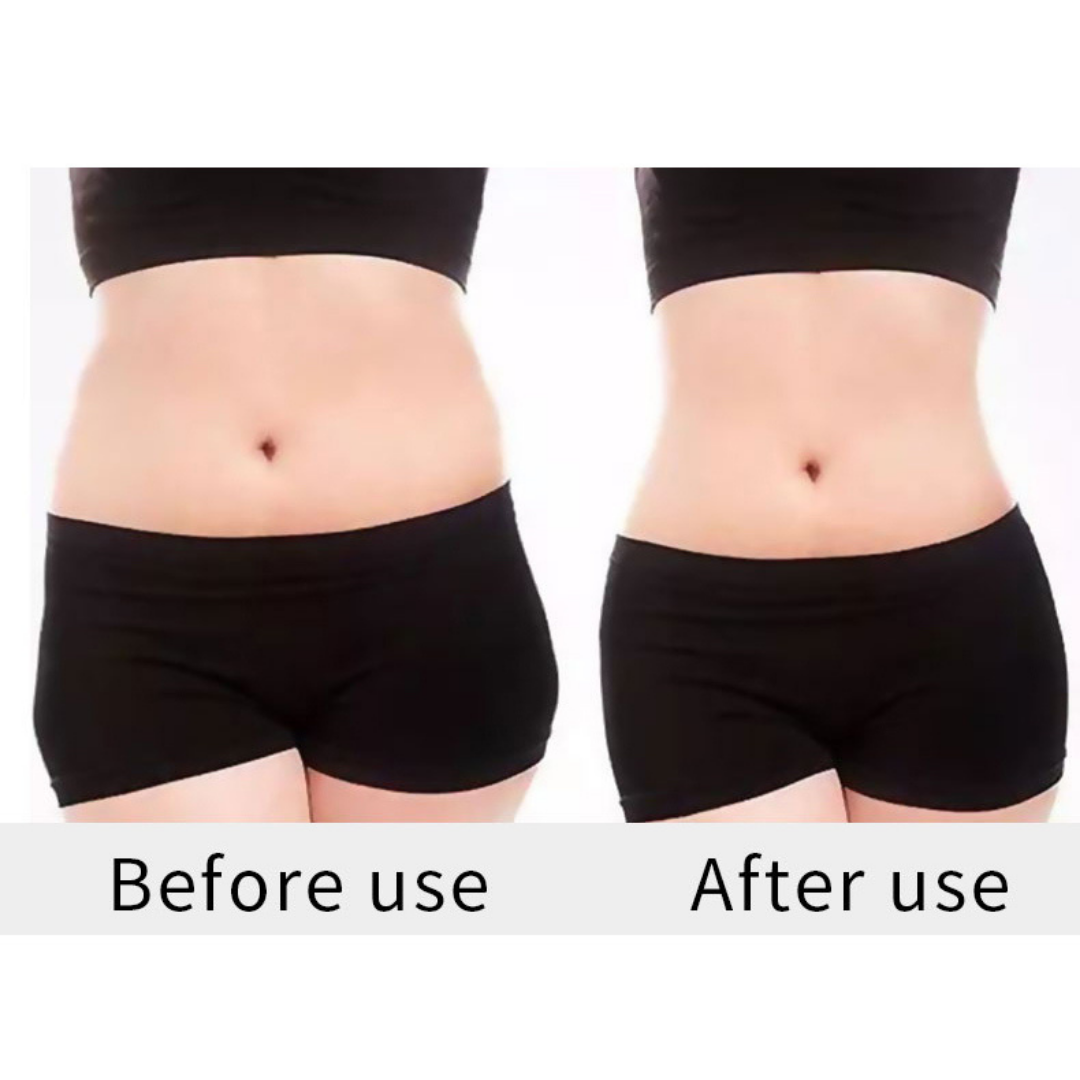 Before and After using Lipo cavitation Machine on Stomach area