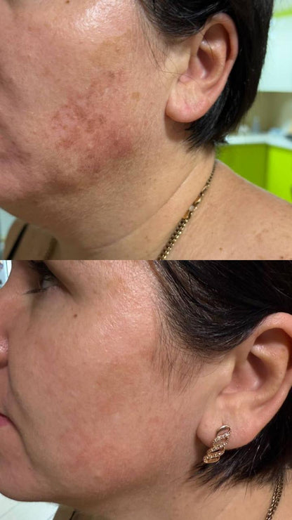 DuoSmooth 2-in-1 Diode Laser + IPL System