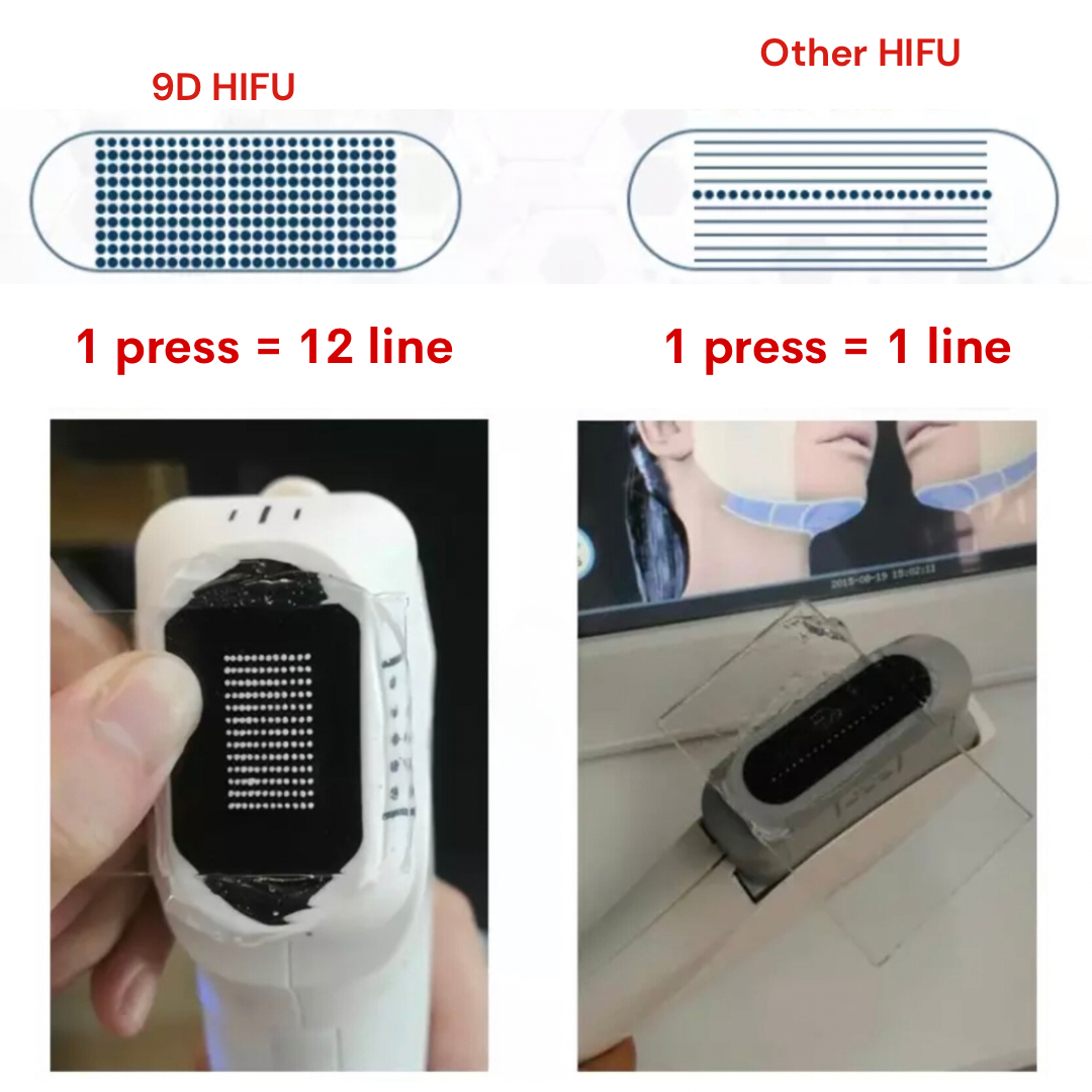 9D Face Lifting HIFU Machine