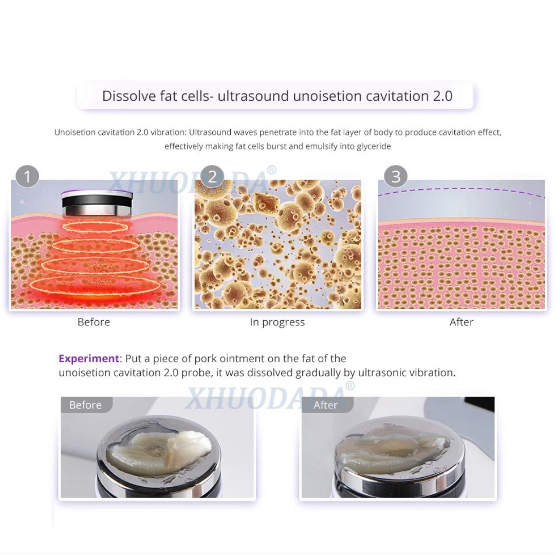 ultrasonic lipo laser cavitation machine treatment detail