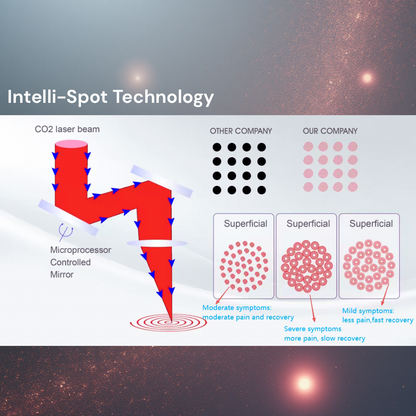 SmartPulse™ COOL Professional CO2 Fractional Laser