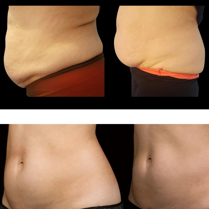 Eris® Lipo Cavitation Machine 9 in 1 Professional