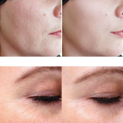 Eris® Lipo Cavitation Machine 9 in 1 Professional