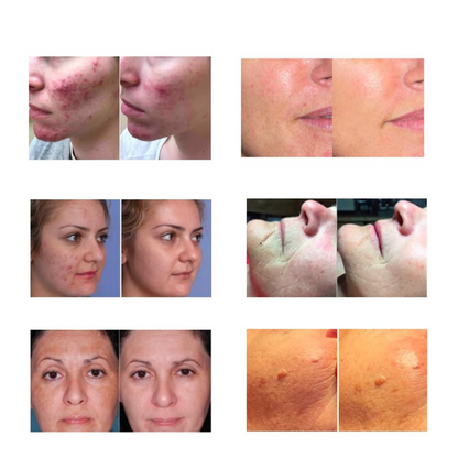 Light Goddess PRO Therapeutic Skin Revitalizer