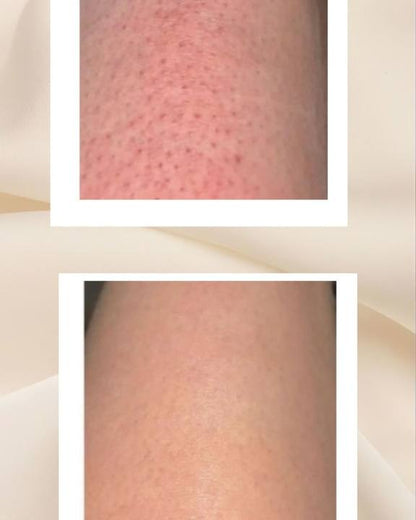 DuoSmooth 2-in-1 Diode Laser + IPL System